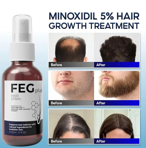 FEG Plus Hair Growth Spray - Anti-Hair Loss Formula
